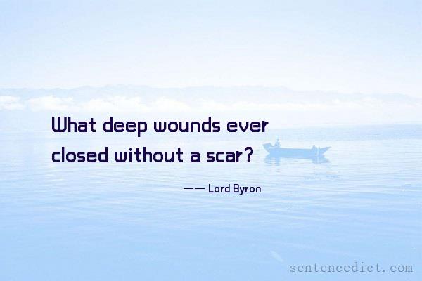 Good sentence's beautiful picture_What deep wounds ever closed without a scar?